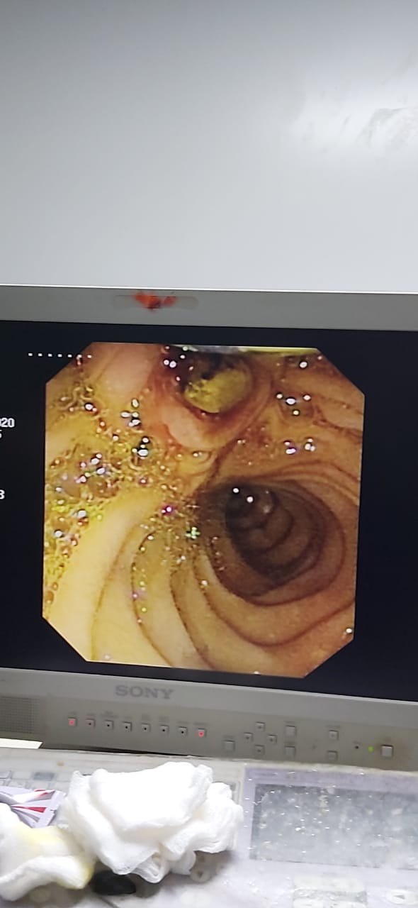 Dr. Netaji Garad - Gastroenterologist in Raipur